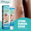 South Moon Lipoma Removal Cream