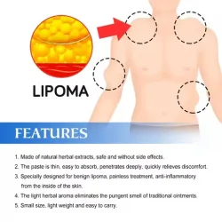 South Moon Lipoma Removal Cream