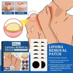 South Moon Lipoma Removal Patch