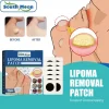 South Moon Lipoma Removal Patch