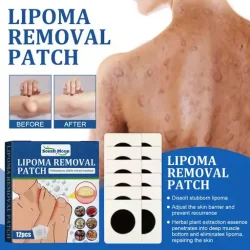 South Moon Lipoma Removal Patch