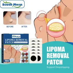 South Moon Lipoma Removal Patch