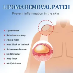 South Moon Lipoma Removal Patch