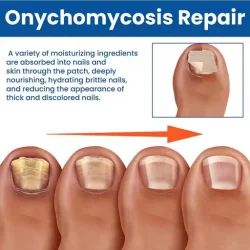 Toenail Fungus Treatment Patches