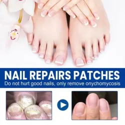 Toenail Fungus Treatment Patches