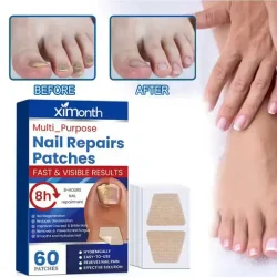 Toenail Fungus Treatment Patches