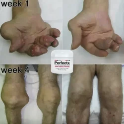 Perfectx Joint and Bone Therapy Cream