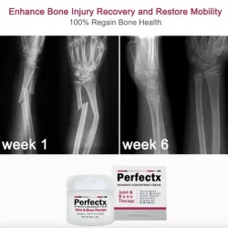 Perfectx Joint and Bone Therapy Cream