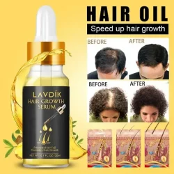 LAVDIK Ginger Fast Hair Growth Serum