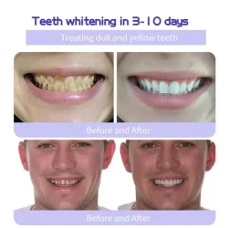 Oyikey Teeth Restoration Mineral Powder